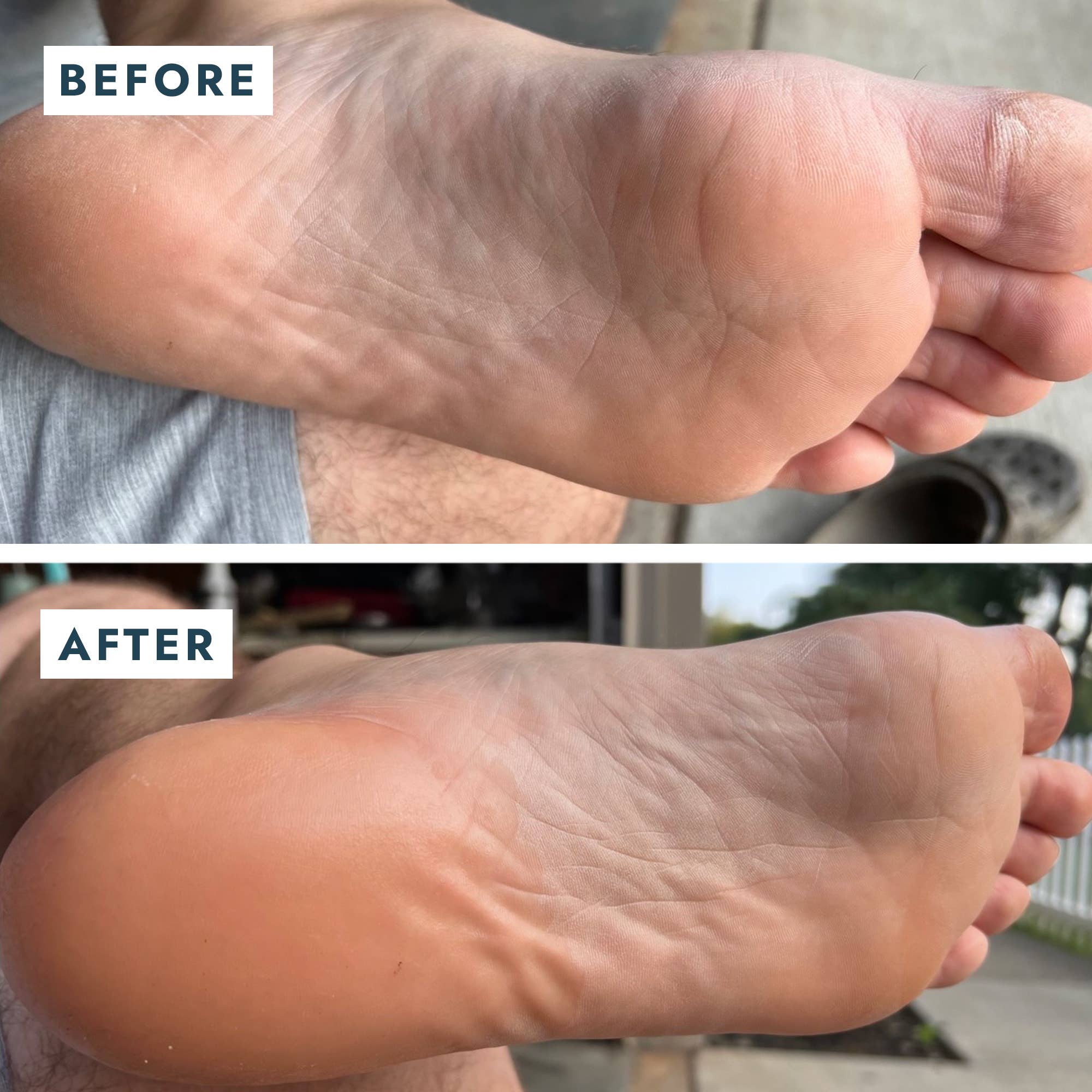 Solemate Heel Repair Balm in Mint before and after photos of someone's foot at Addison West