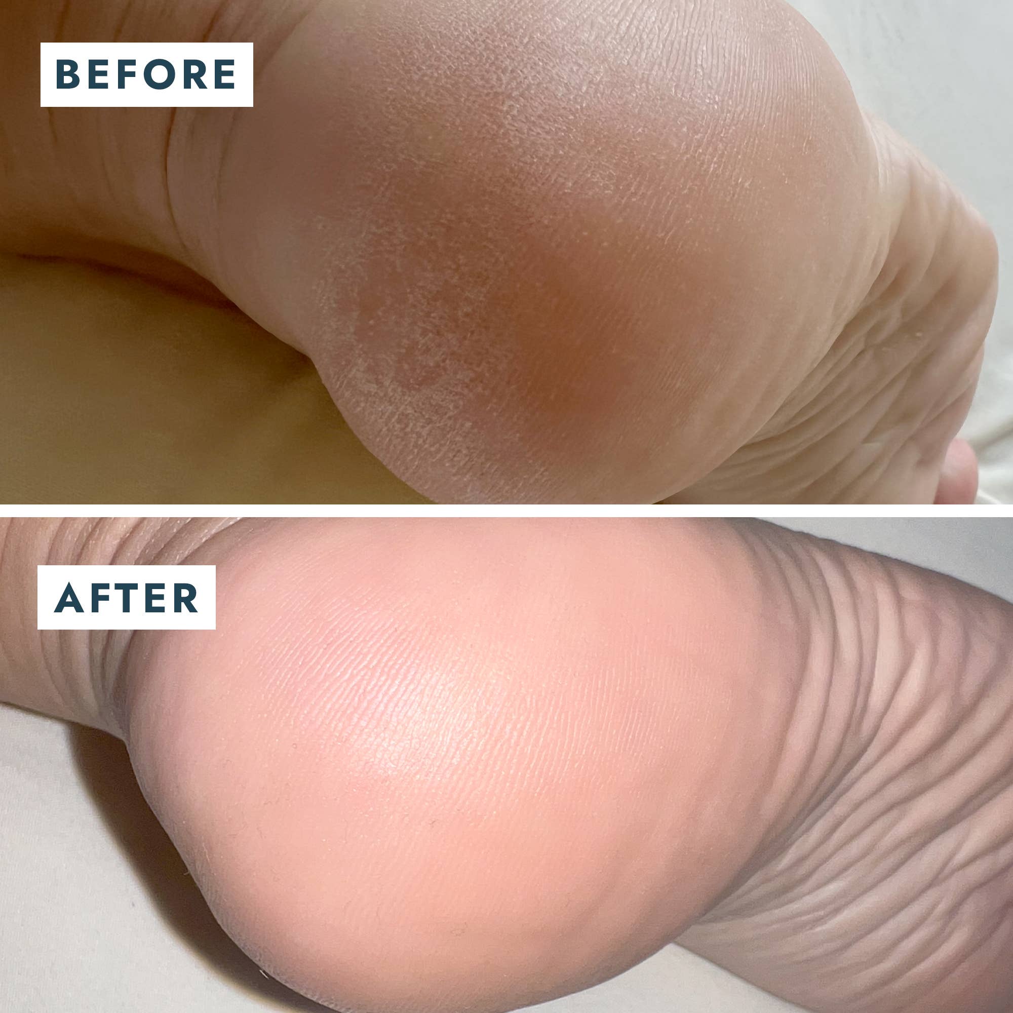 Solemate Heel Repair Balm in Mint before and after photos of someone's foot at Addison West