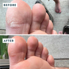 Solemate Heel Repair Balm in Mint before and after photos of someone's foot at Addison West