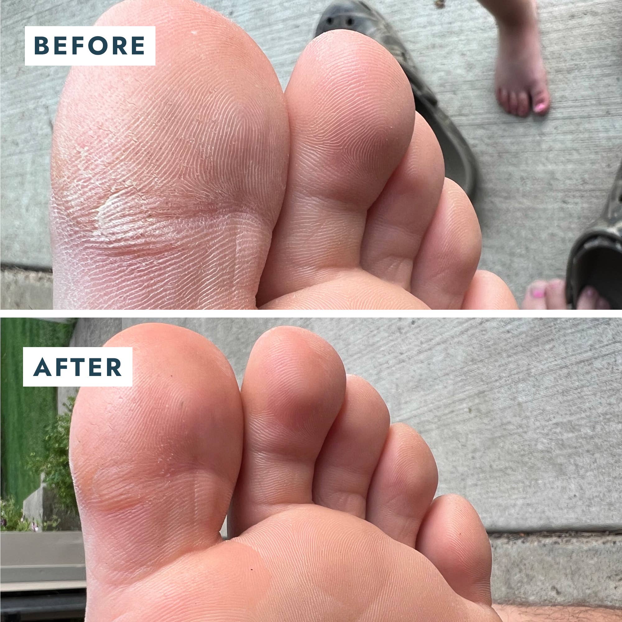 Solemate Heel Repair Balm in Mint before and after photos of someone's foot at Addison West