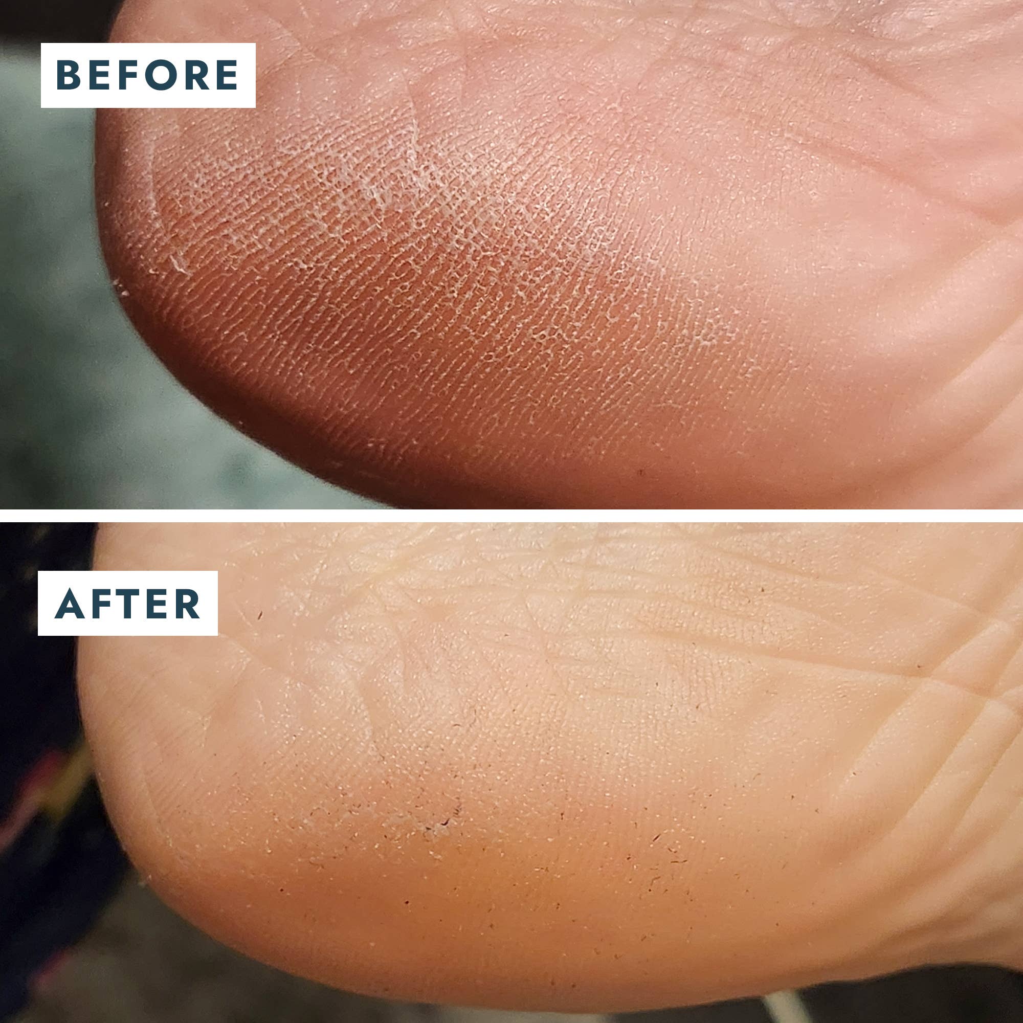 Solemate Heel Repair Balm in Mint before and after photos of someone's foot at Addison West